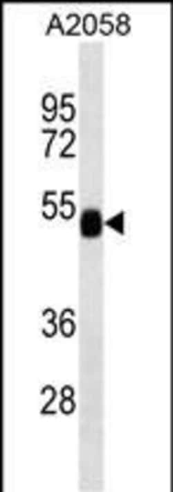 FUCA2 Monoclonal Antibody (234CT20.2.1):Antibodies, Monoclonal