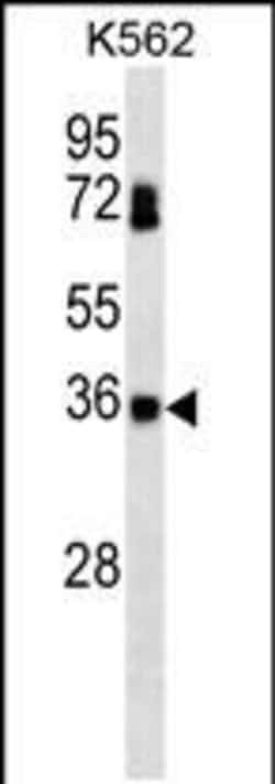 Invitrogen CK2 beta Monoclonal Antibody (260CT10.1.1) 400 &mu;L; Unconjugated:Antibodies,