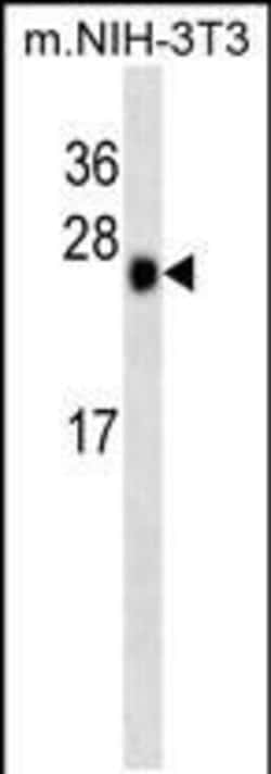 Invitrogen CK2 beta Monoclonal Antibody (260CT10.1.1) 400 &mu;L; Unconjugated:Antibodies,