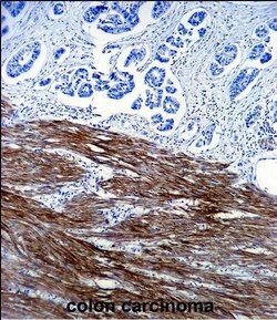 Invitrogen ACTA1 Monoclonal Antibody (337CT30.10.1) 400 &mu;L; Unconjugated:Antibodies,