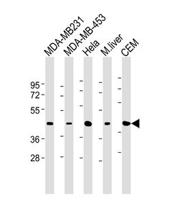 Invitrogen ACTA1 Monoclonal Antibody (337CT30.10.1) 400 &mu;L; Unconjugated:Antibodies,