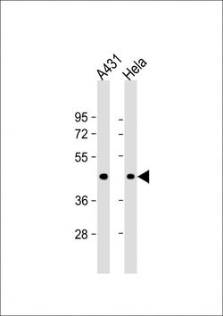 Invitrogen ACTA1 Monoclonal Antibody (337CT30.10.1) 400 &mu;L; Unconjugated:Antibodies,