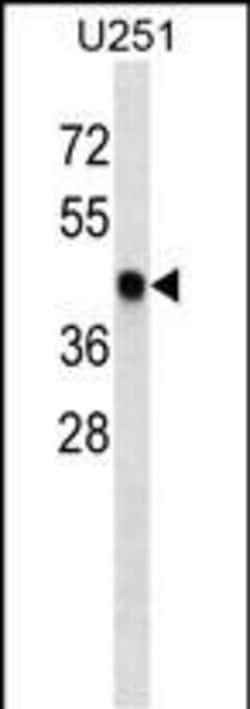 Invitrogen SNX6 Monoclonal Antibody (335CT6.4.6) 400 &mu;L | Buy Online | Invitrogen&trade; | Fisher Scientific