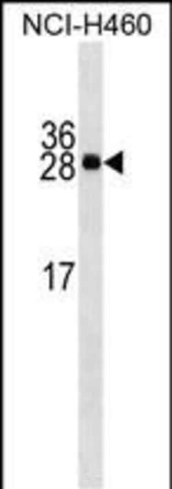 Invitrogen Serum Amyloid P Monoclonal Antibody (342CT9.4.7) 400 &mu;L;