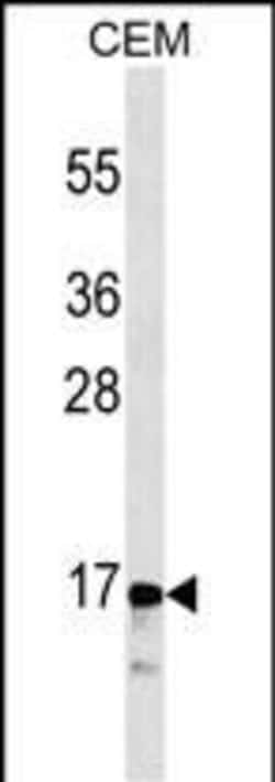 Invitrogen Calcitonin Monoclonal Antibody (406CT21.4.3) 400 &mu;L; Unconjugated:Antibodies,