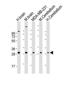 Invitrogen RAB23 Monoclonal Antibody (427CT2.1.1) 400 &mu;L; Unconjugated:Antibodies,