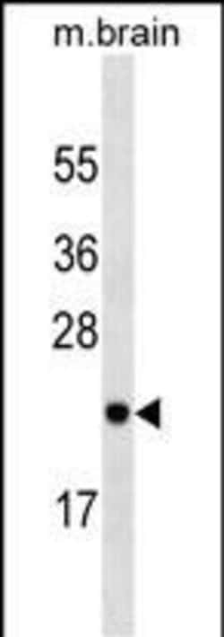 Invitrogen RAB23 Monoclonal Antibody (427CT2.1.1) 400 &mu;L; Unconjugated:Antibodies,