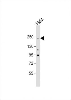 Invitrogen NOTCH3 Monoclonal Antibody (487CT6.9.2) 400 &mu;L; Unconjugated:Antibodies,