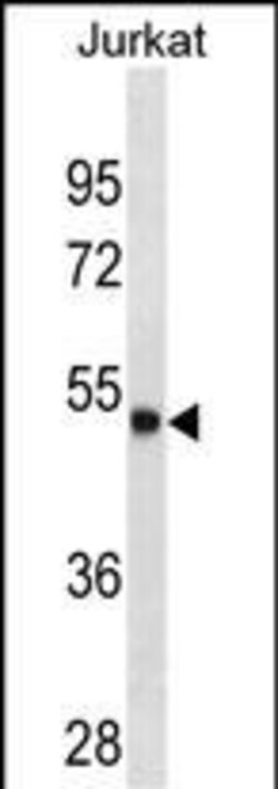 Invitrogen Arylsulfatase A Monoclonal Antibody (498CT24.1.2) 400 &mu;L;