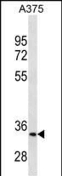 Invitrogen MC1R Monoclonal Antibody (578CT6.2.3) 400 &mu;L | Buy Online | Invitrogen&trade; | Fisher Scientific