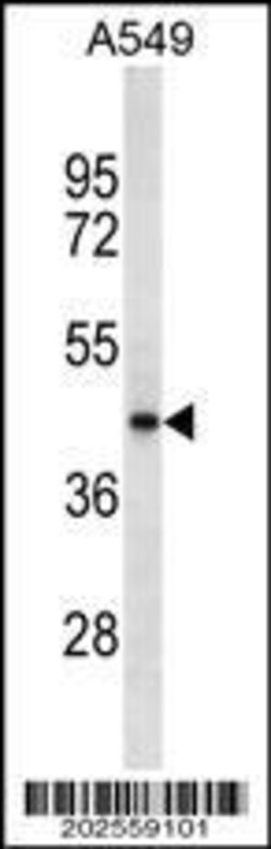 Invitrogen Tecrl Monoclonal Antibody (601CT22.4.3) 100 &mu;L | Buy Online | Invitrogen&trade; | Fisher Scientific
