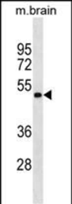 Invitrogen GNAS Monoclonal Antibody (559CT 16.1.3) 100 &mu;L; Unconjugated:Antibodies,