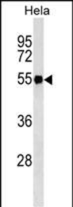 Invitrogen Fibrinogen gamma Monoclonal Antibody (546CT11.4.3) 100 &mu;L | Buy Online | Invitrogen&trade; | Fisher Scientific