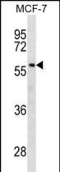 Invitrogen GBA Monoclonal Antibody (660CT8.6.6.2) 100 &mu;L; Unconjugated:Antibodies,