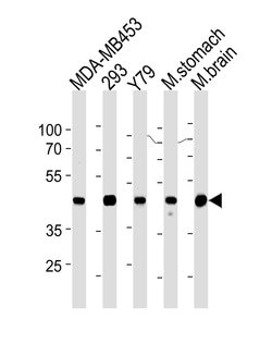 Invitrogen Creatine Kinase BB Monoclonal Antibody (893CT29.1.1) 400 &mu;L;