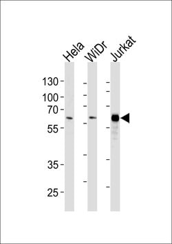 HDAC1 Monoclonal Antibody (1061CT1.3.1):Antibodies, Monoclonal