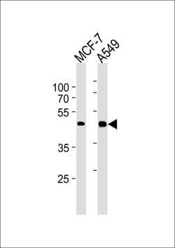 Invitrogen CDK20 Monoclonal Antibody (885CT27.1.1) 400 &mu;L; Unconjugated:Antibodies,