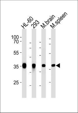 Invitrogen Aldolase C Monoclonal Antibody (859CT9.5.3) 400 &mu;L; Unconjugated:Antibodies,