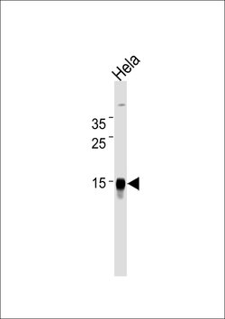 CDA Monoclonal Antibody (921CT14.2.1):Antibodies, Monoclonal