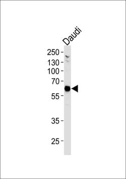 Invitrogen USP22 Monoclonal Antibody (1154CT13.1.3.1) 400 &mu;L; Unconjugated:Antibodies,