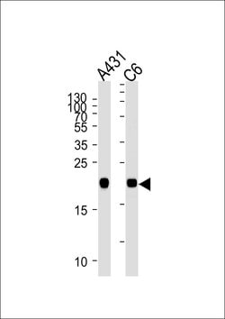 Invitrogen N-Ras Monoclonal Antibody (822CT17.5.1) 400 &mu;L; Unconjugated:Antibodies,