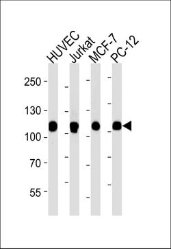Invitrogen TOP1 Monoclonal Antibody (1291CT875.142.166) 400 &mu;L; Unconjugated:Antibodies,