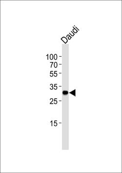 Invitrogen Bcl-10 Monoclonal Antibody (1185CT13.2.1.2) 400 &mu;L; Unconjugated:Antibodies,