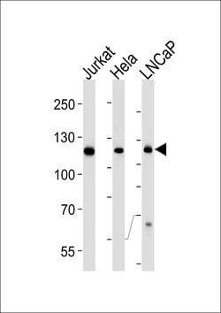 Invitrogen USP11 Monoclonal Antibody (1220CT620.193.189) 400 &mu;L; Unconjugated:Antibodies,