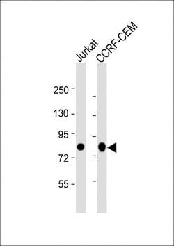 Invitrogen Myb Monoclonal Antibody (1279CT309.289) 400 &mu;L; Unconjugated:Antibodies,