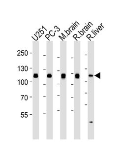 Invitrogen USP5 Monoclonal Antibody (1340CT704.170.140) 400 &mu;L; Unconjugated:Antibodies,