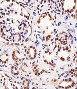Invitrogen PPAR alpha Monoclonal Antibody (1331CT894.186.143) 400 &mu;L;