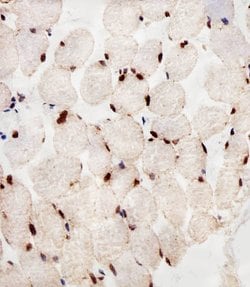 Invitrogen PPAR alpha Monoclonal Antibody (1331CT894.186.143) 400 &mu;L;
