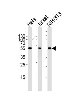 Invitrogen PPAR alpha Monoclonal Antibody (1331CT894.186.143) 400 &mu;L;
