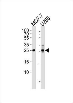 Invitrogen p27 Kip1 Monoclonal Antibody (1373CT407.103.103) 400 &mu;L | Buy Online | Invitrogen&trade; | Fisher Scientific