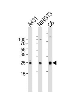 Invitrogen RAC1 Monoclonal Antibody (1301CT276.121.104) 400 &mu;L; Unconjugated:Antibodies,