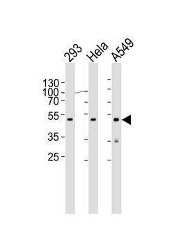 CBX8 Monoclonal Antibody (1214CT171.154.107):Antibodies, Monoclonal