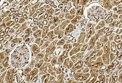 Invitrogen ULK3 Monoclonal Antibody (1404CT148.89.25) 400 &mu;L; Unconjugated:Antibodies,