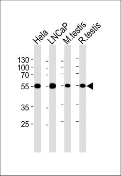 Invitrogen ULK3 Monoclonal Antibody (1404CT148.89.25) 400 &mu;L; Unconjugated:Antibodies,