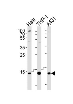 Invitrogen VAMP8 Monoclonal Antibody (1414CT354.12.23.93) 400 &mu;L; Unconjugated:Antibodies,