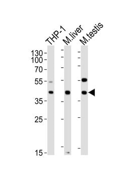 ATG3 Monoclonal Antibody (1377CT239.6.1.12):Antibodies, Monoclonal
