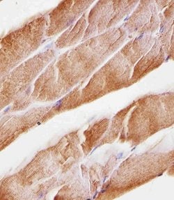 Invitrogen MUSK Monoclonal Antibody (1429CT456.173.44) 400 &mu;L; Unconjugated:Antibodies,