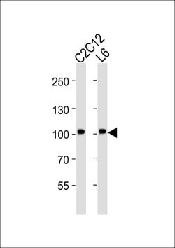 Invitrogen MUSK Monoclonal Antibody (1429CT456.173.44) 400 &mu;L; Unconjugated:Antibodies,