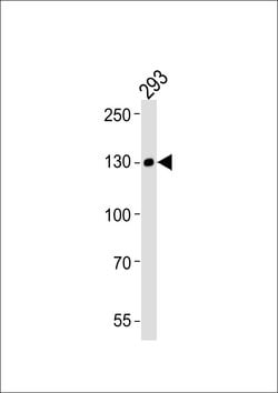 EphA6 Monoclonal Antibody (1426CT591.205.91.119):Antibodies, Monoclonal