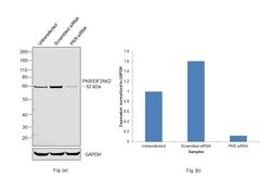Invitrogen PKR Monoclonal Antibody (1441CT628.33.40) 400 &mu;L; Unconjugated:Antibodies,