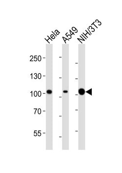 Invitrogen FER Monoclonal Antibody (1457CT181.12.17) 400 &mu;L; Unconjugated:Antibodies,