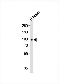 Invitrogen TrkB Monoclonal Antibody (1446CT494.85.83.49) 400 &mu;L; Unconjugated:Antibodies,