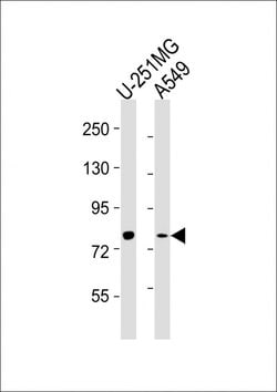 Invitrogen FES Monoclonal Antibody (1467CT528.22.17) 400 &mu;L; Unconjugated:Antibodies,