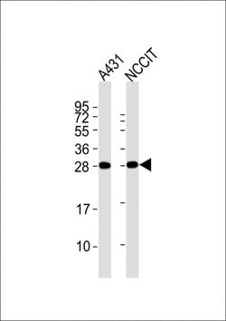 BAP31 Monoclonal Antibody (1502CT208.31.16):Antibodies, Monoclonal