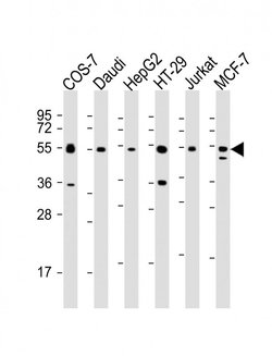 Invitrogen IRF3 Monoclonal Antibody (1522CT766.58.24) 200 &mu;L; Unconjugated:Antibodies,