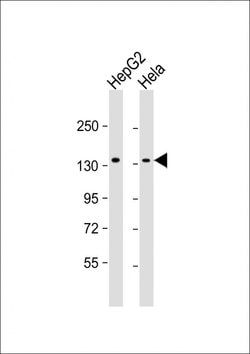 Invitrogen RBM6 Monoclonal Antibody (1583CT111.17.7.37) 200 &mu;L; Unconjugated:Antibodies,